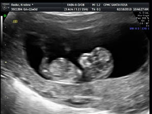 BabyB.JPG