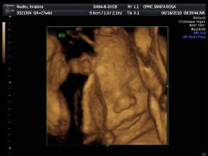 webassets/Roman_28Weeks.JPG