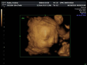 webassets/Roman_28Weeks.JPG